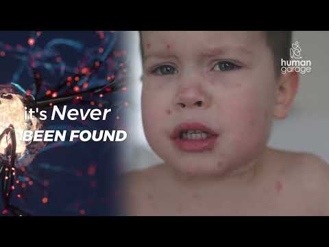 Why This Doctor, Tom Cowan, Says Viruses Aren't Real & The Heart Isn't A Pump